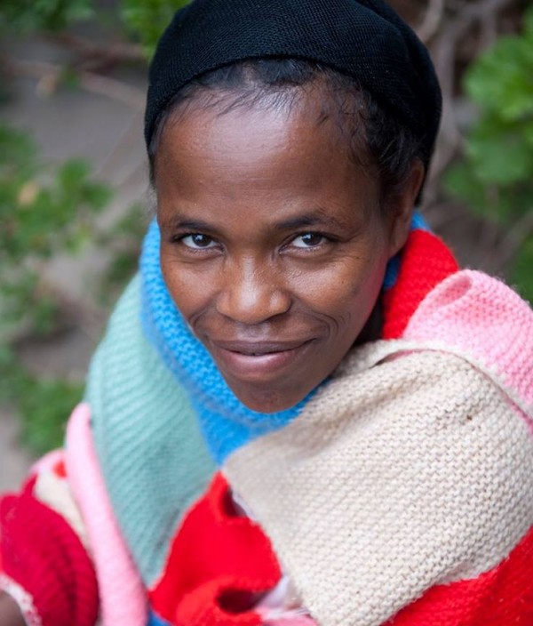 OBSTETRIC FISTULA HAMLIN FISTULA ETHIOPIA (AUSTRALIA) - Shop the online shop and hange the life of women living with obstetric fistula in Ethiopia today. More charity gift ideas for Mother's Day on We-are-scout.com.